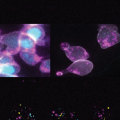 Transcriptional Regulation in Gene Expression Control