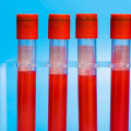 Types of Genetic Testing