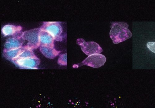 Transcriptional Regulation in Gene Expression Control