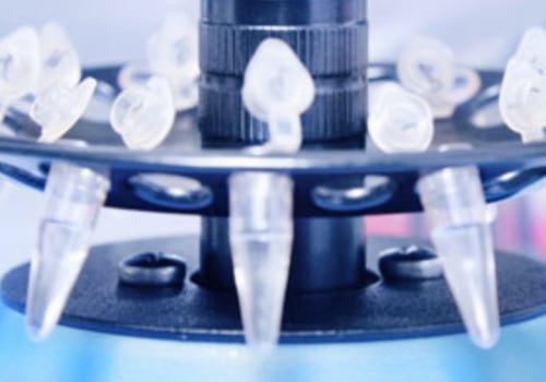 Chromatin Immunoprecipitation (ChIP) Profiling