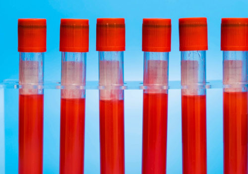 Types of Genetic Testing